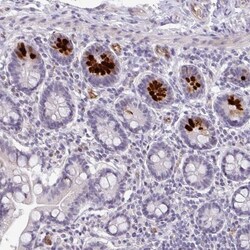 anti-SIDT2, Polyclonal, Novus Biologicals 0.1mL; Unlabeled:Antibodies,